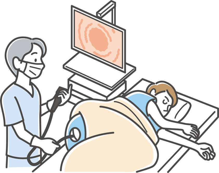大腸内視鏡検査の役割